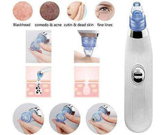 Blackhead Removal Machine – Derma Suction 4-in-1